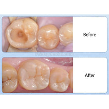 10Pcs Capsule/Box A1/A2/A3/A3.5 Universal Dental Composite Resin Light Cure Capsule