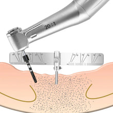 Dental Implant Locating Guide Positioning Locator Angle Ruler Stainless steel