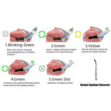 Dental Implant Locator Wireless Three-Dimensional Implant Detector 270℃ Rotating Finder