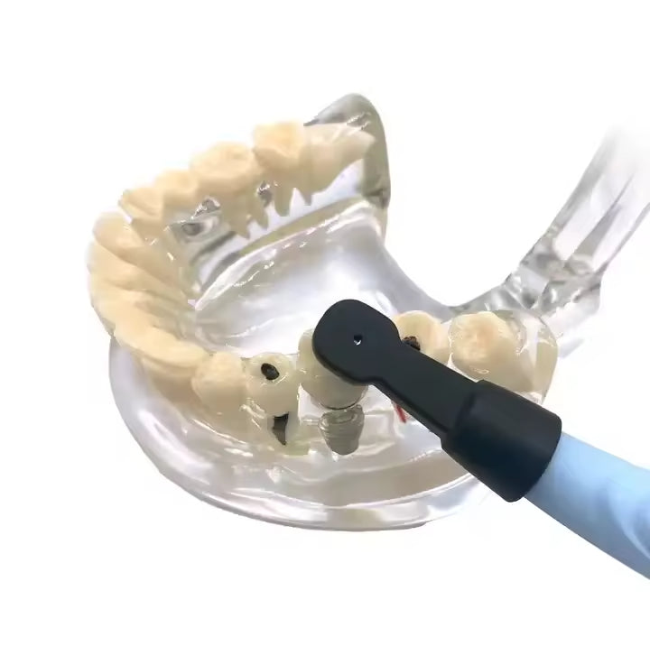 Dental Implant Locator Wireless Three-Dimensional Implant Detector 270 ...