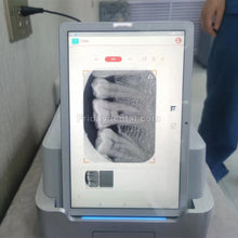 TYRIS TR310 Dental Phosphor Plate PSP Scanner with PAD Image Plate