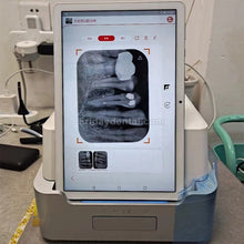 TYRIS TR310 Dental Phosphor Plate PSP Scanner with PAD Image Plate