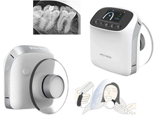 XVbeam2000 Portable Dental X-Ray Unit High Frequency Handheld XRay Machine 3.0-inch LCD screen