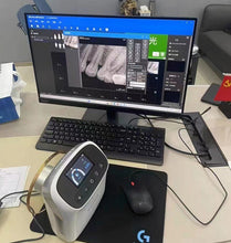 XVbeam2000 Portable Dental X-Ray Unit High Frequency Handheld XRay Machine 3.0-inch LCD screen