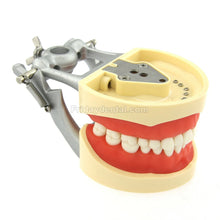 Dental Typodont Model 32Pcs Removable Teeth Mounting Pole Fit Kilgore Nissin 200